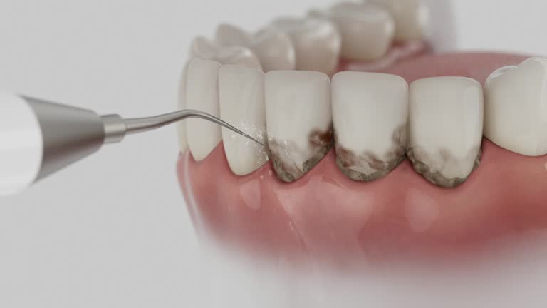 Trusted Tooth Extraction service in Trinity, TX - Dentist Open Now